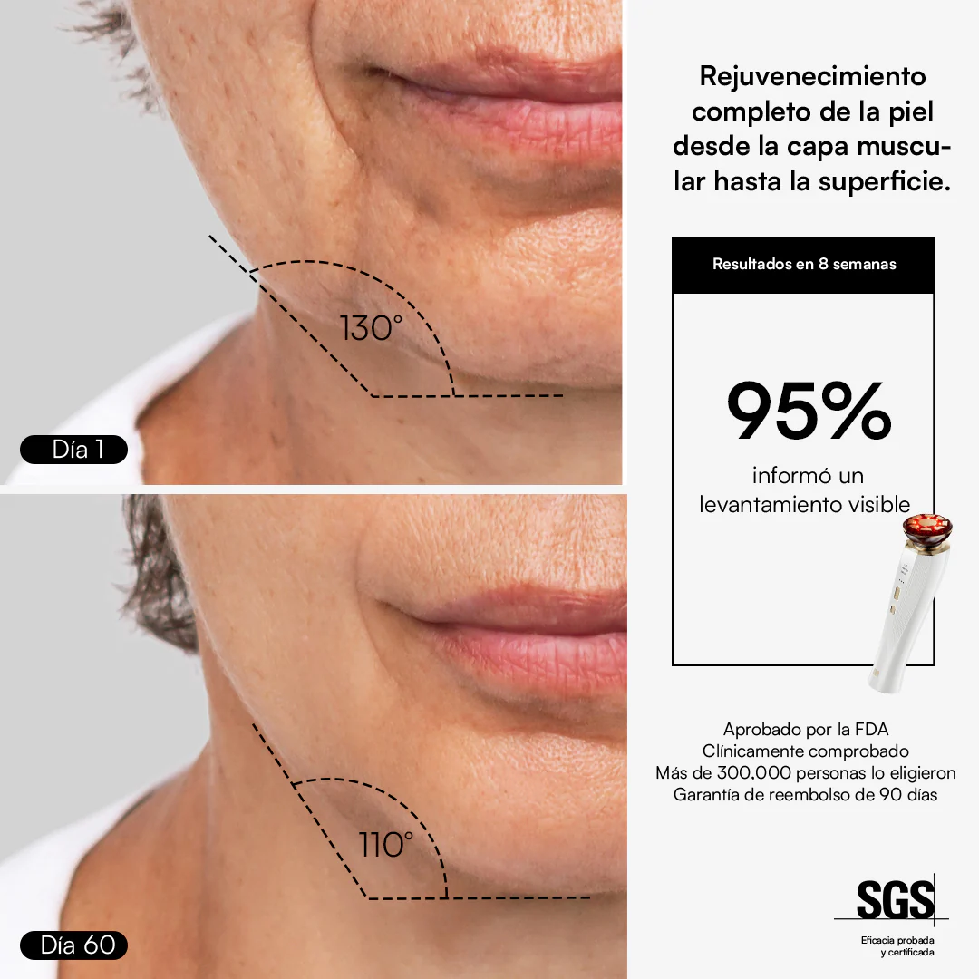 INIA FLARE Dispositivo Facial de Microcorriente - Image 6