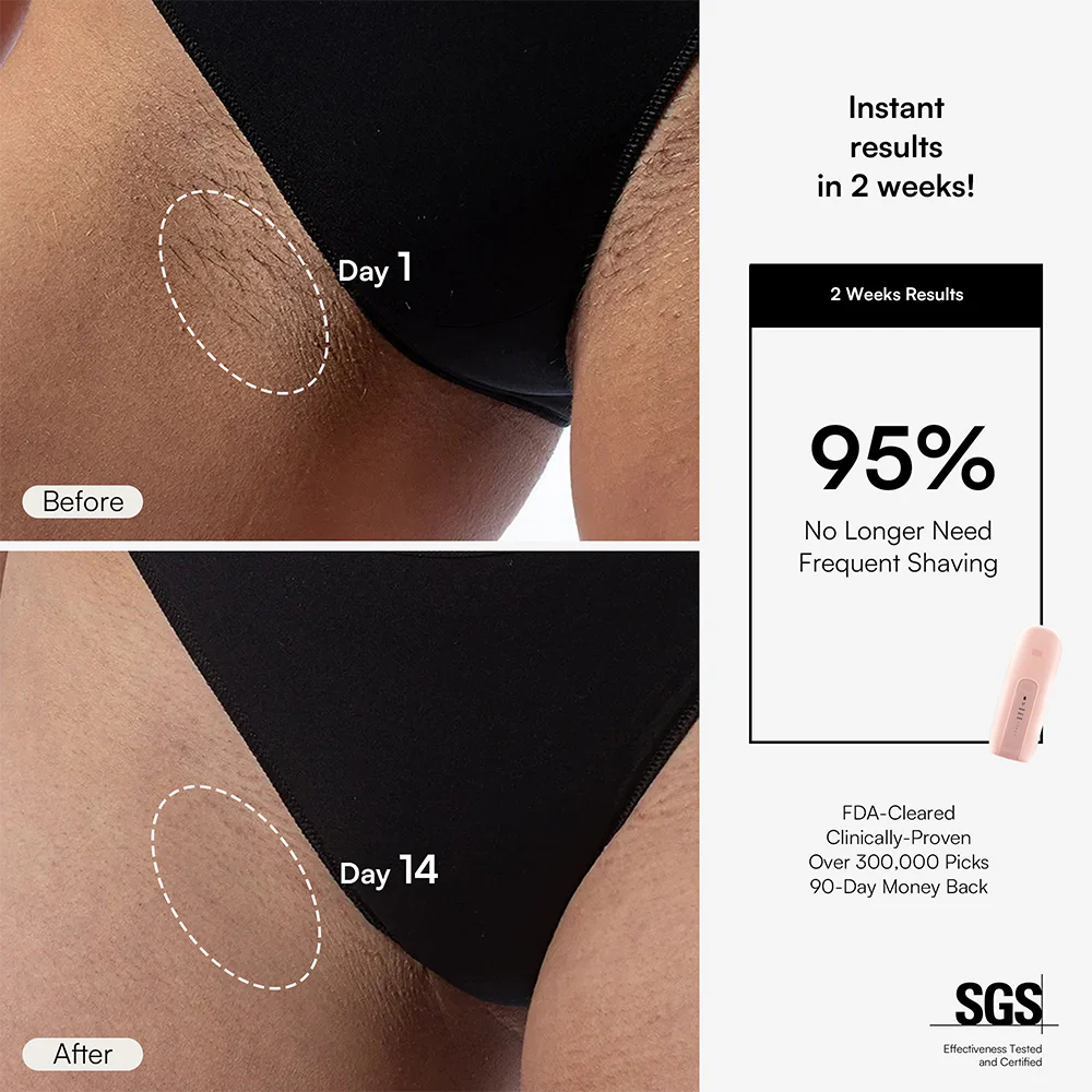 INIA FOND IPL Laser Hair Removal with Facial Mask - Image 4