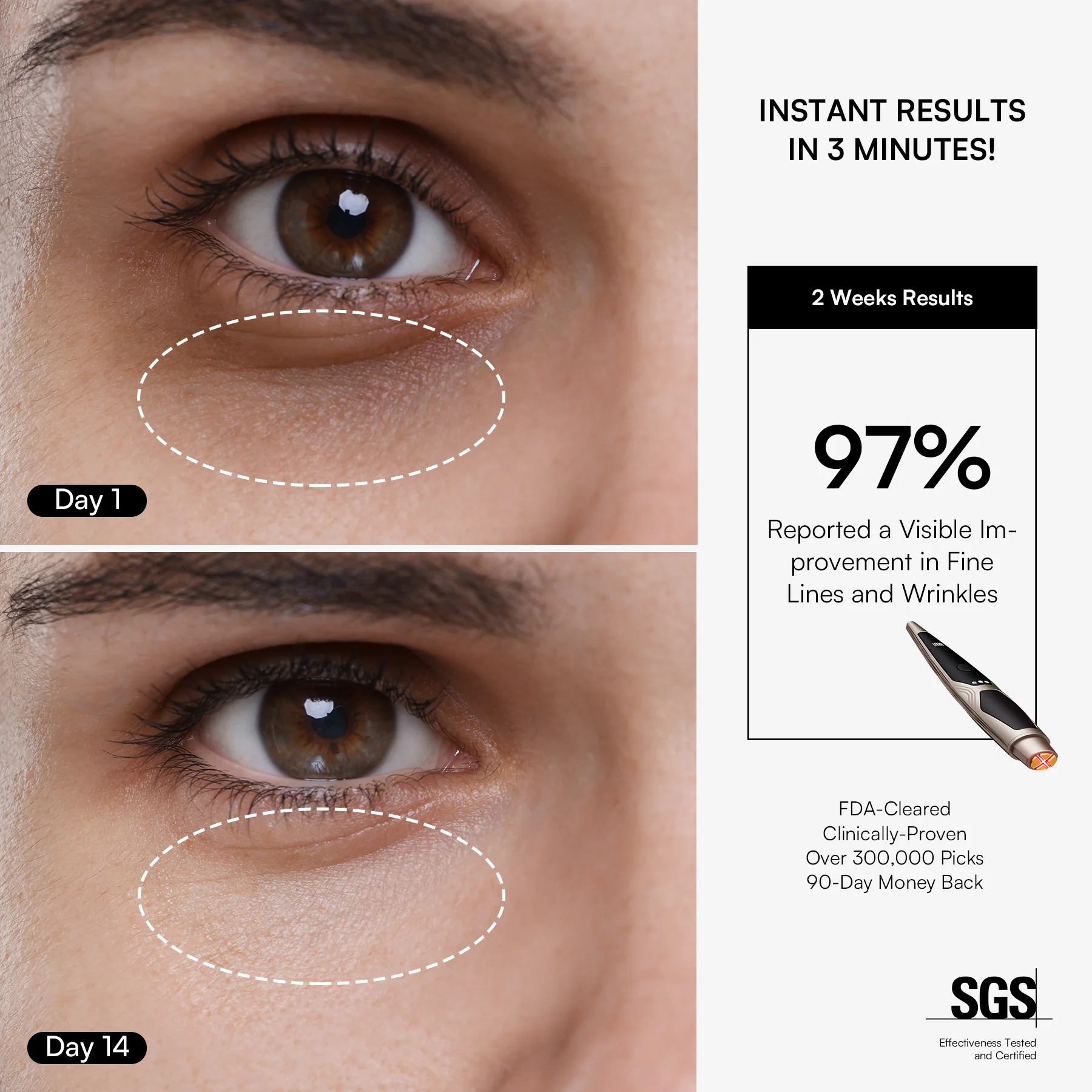 INIA LUMIN Eye Skincare Device FDA-Cleared - Image 3