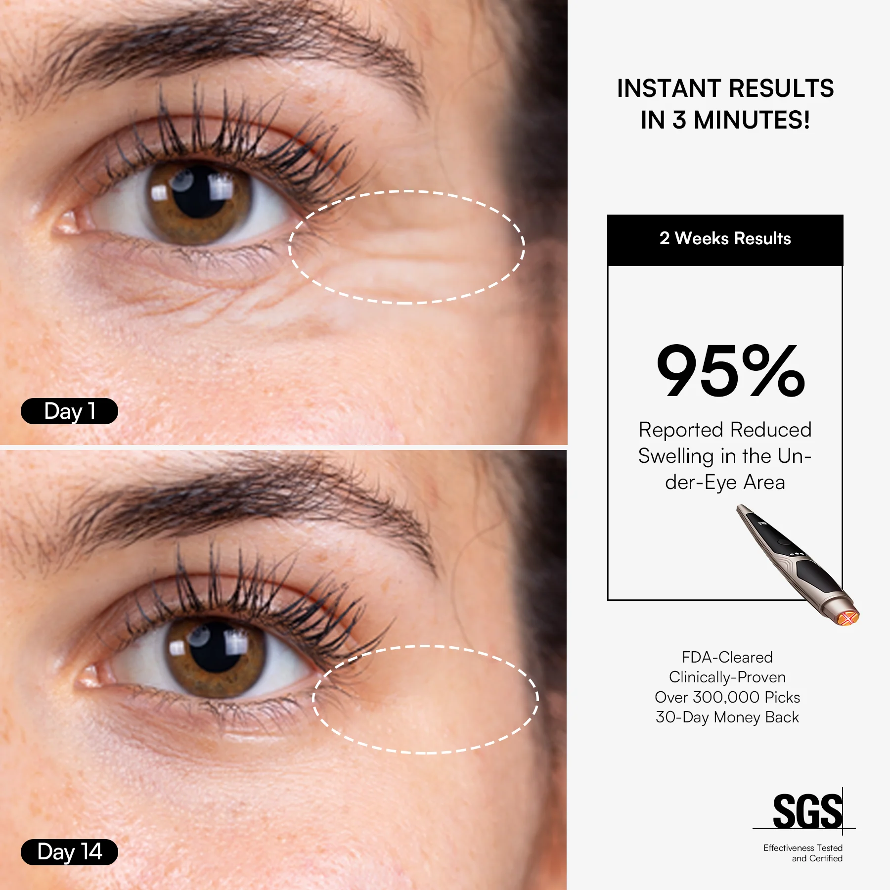 INIA LUMIN Eye Skincare Device FDA-Cleared - Image 5