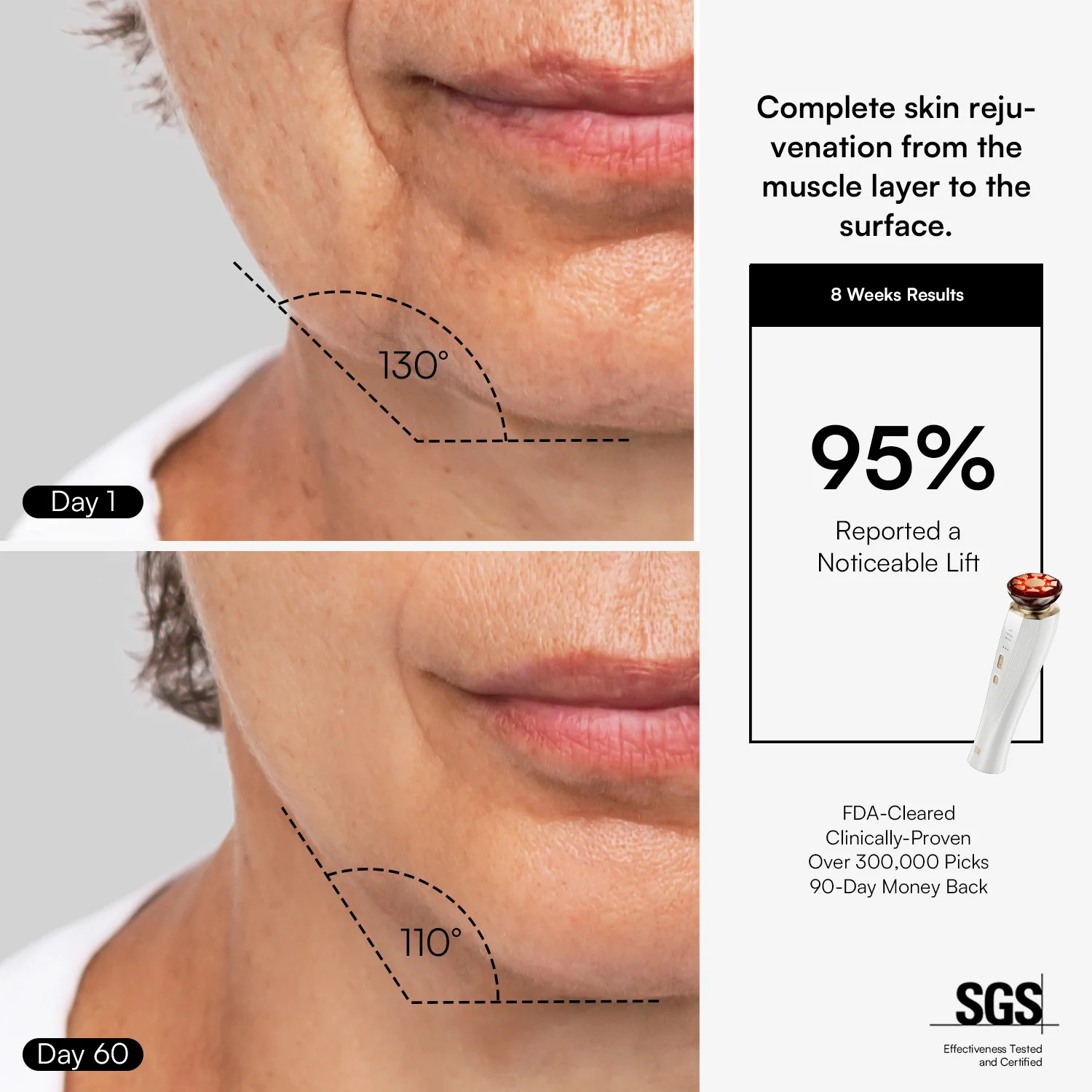 INIA FLARE Microcurrent Facial Device for Face and Neck - Image 3