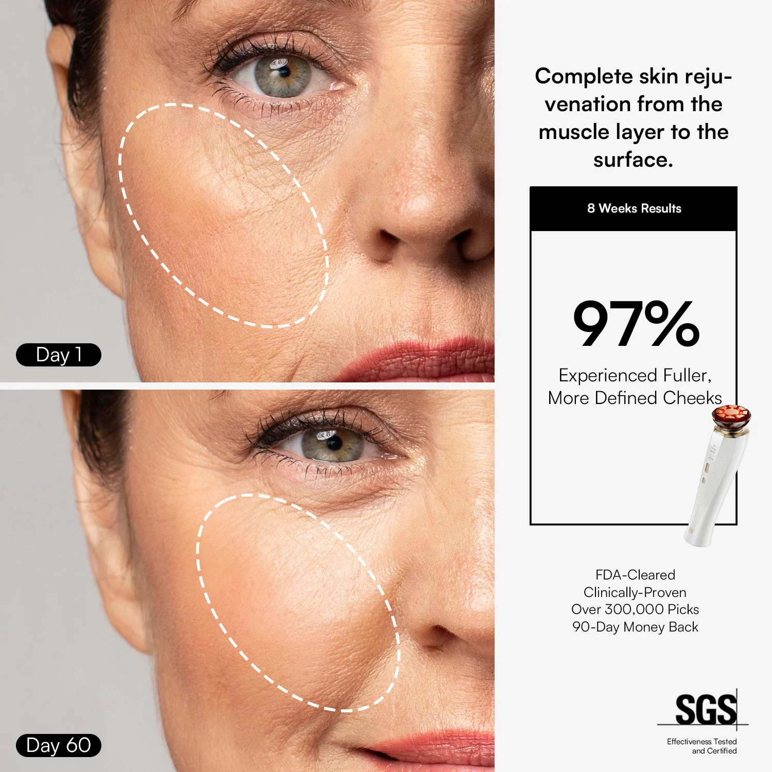 INIA FLARE Microcurrent Facial Device for Face and Neck - Image 4