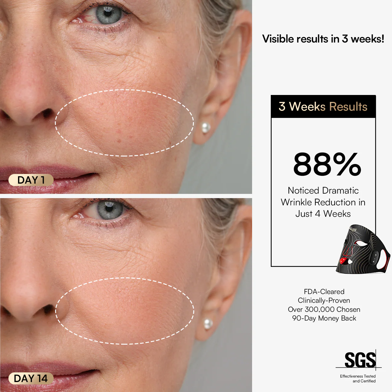INIA GLOW Wireless Red Light Therapy Mask FDA-Cleared - Image 7