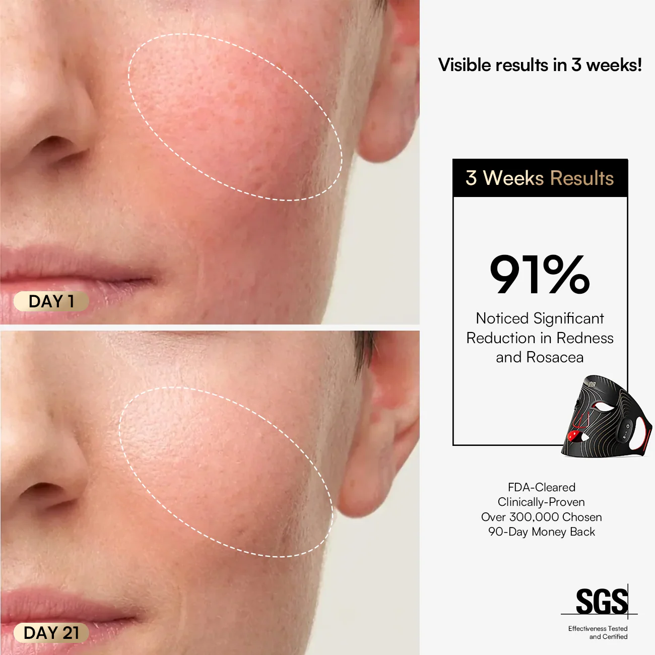 INIA GLOW Wireless Red Light Therapy Mask FDA-Cleared - Image 6