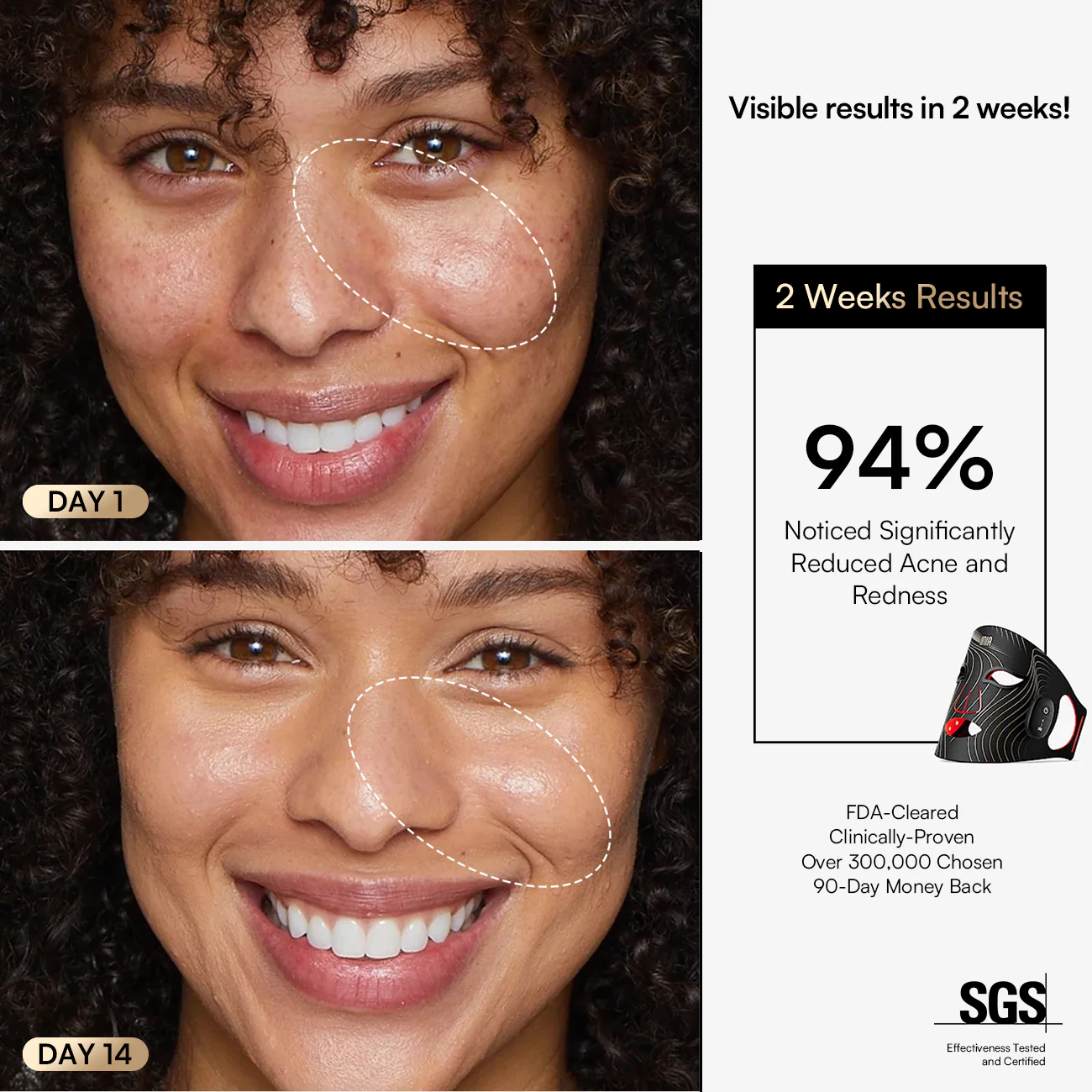 INIA GLOW Wireless Red Light Therapy Mask FDA-Cleared - Image 5