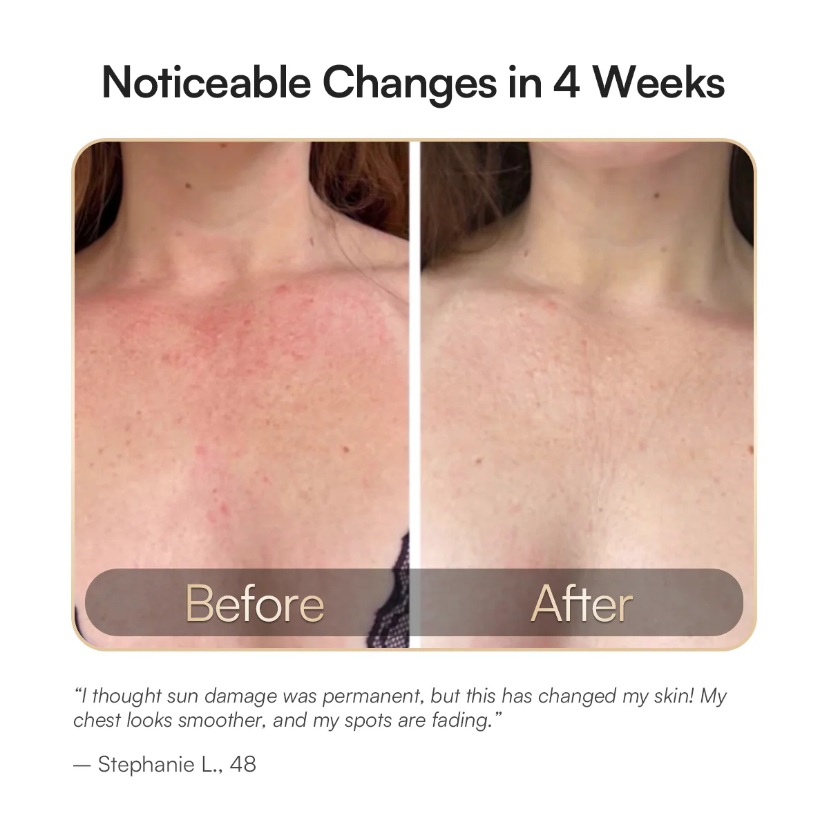 INIA Red Light Therapy Mask for Neck & Décolleté - Image 5