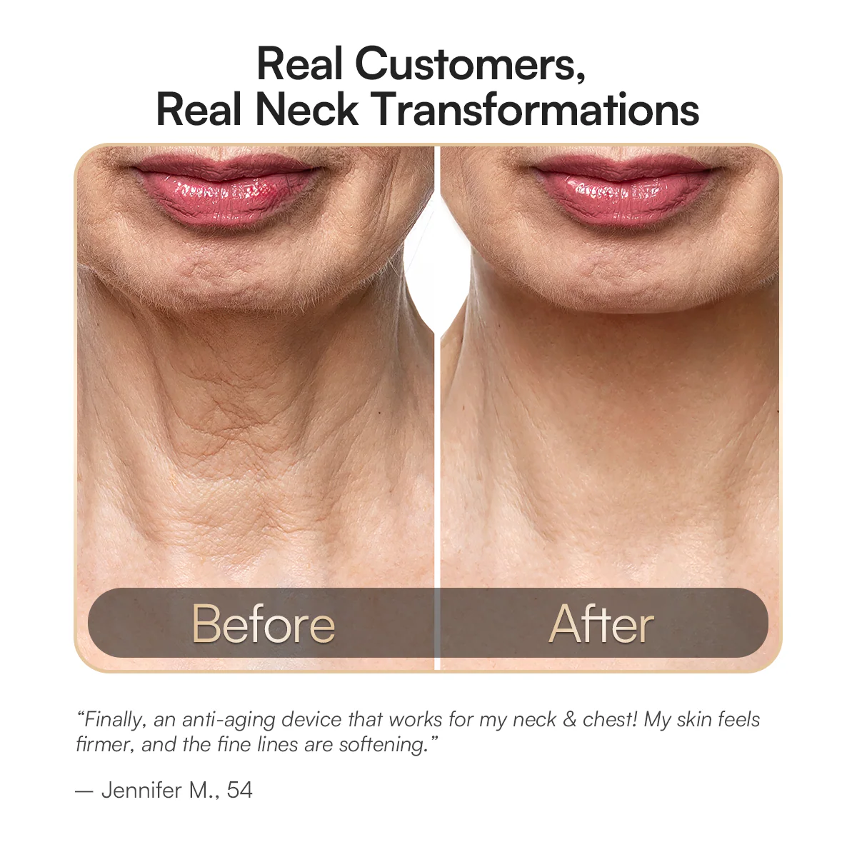 INIA Red Light Therapy Mask for Neck & Décolleté - Image 3