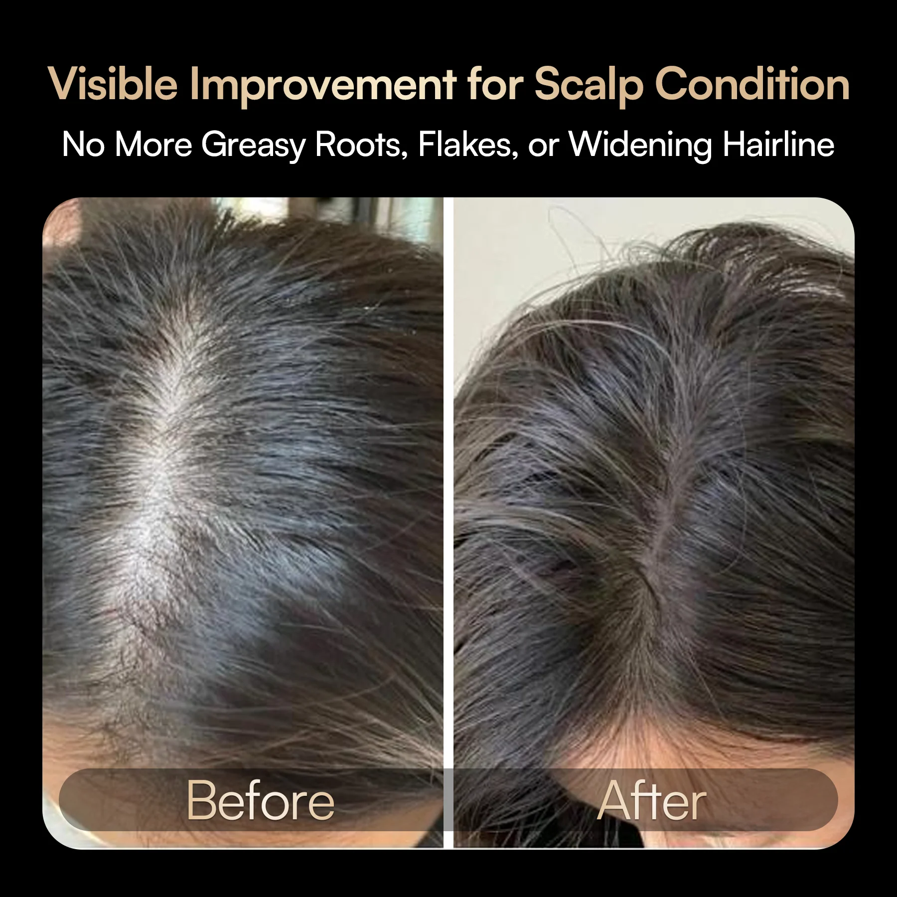 INIA VIBRA 4-in-1 Scalp Therapy Device FDA-Cleared - Image 4