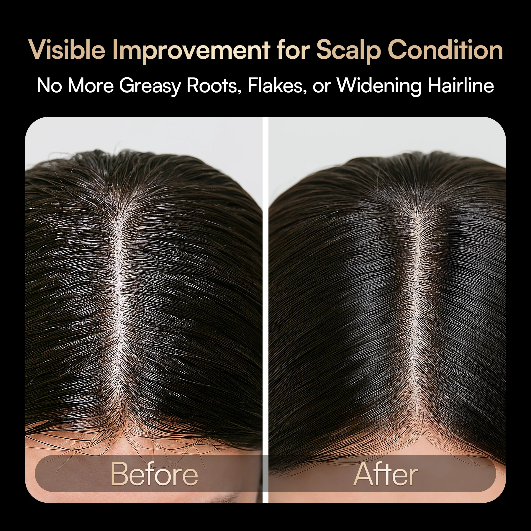 INIA VIBRA 4-in-1 Scalp Therapy Device FDA-Cleared - Image 5